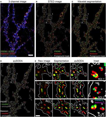 Activity-Dependent Remodeling of Synaptic Protein Organization Revealed by High Throughput Analysis of STED Nanoscopy Images